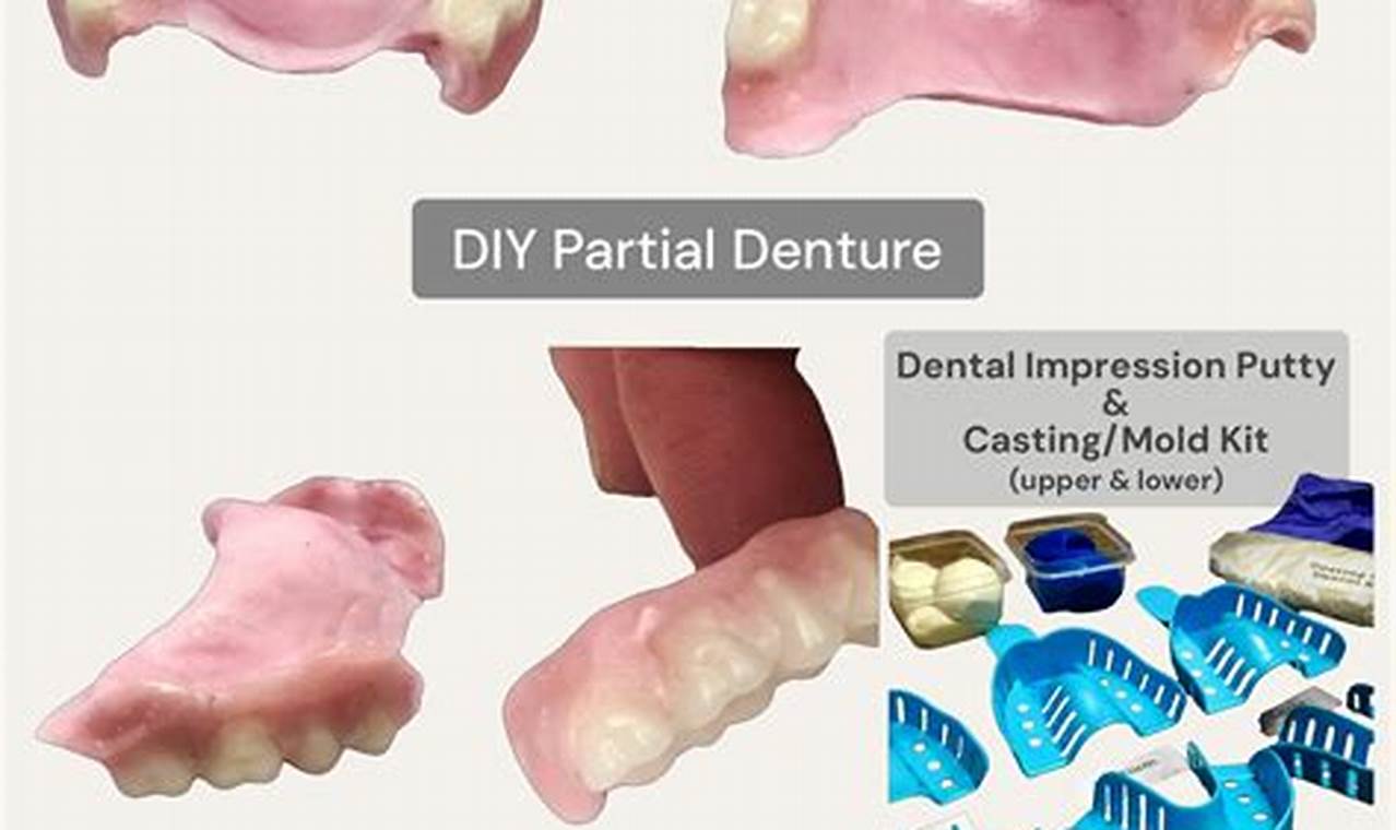 Find The Best DIY Partial Denture Kit - Options & Guide | The DIY Hub: Creative Crafts, Repairs & Life Hacks