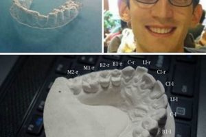 DIY Invisalign: Is Pro Oversight Needed? | The DIY Hub: Creative Crafts, Repairs & Life Hacks