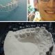 DIY Invisalign: Is Pro Oversight Needed? | The DIY Hub: Creative Crafts, Repairs & Life Hacks
