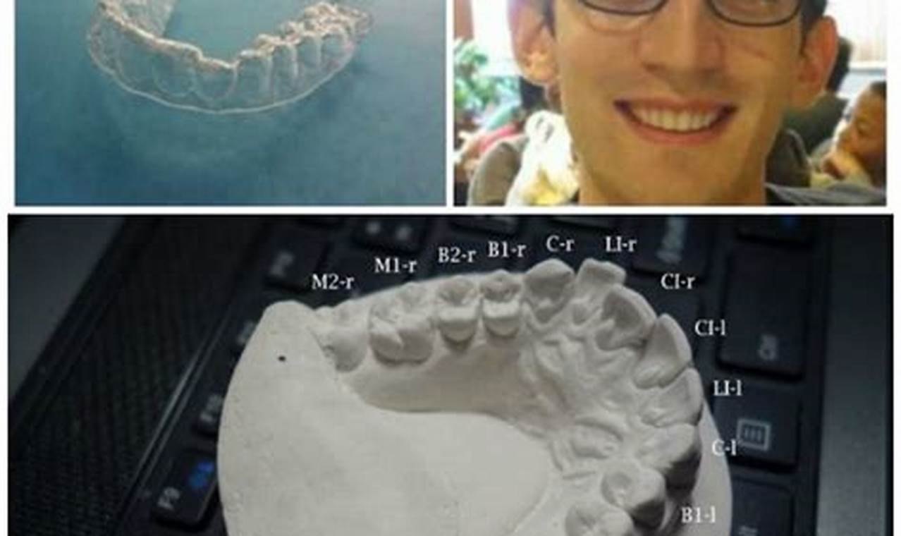 DIY Invisalign: Is Pro Oversight Needed? | The DIY Hub: Creative Crafts, Repairs & Life Hacks